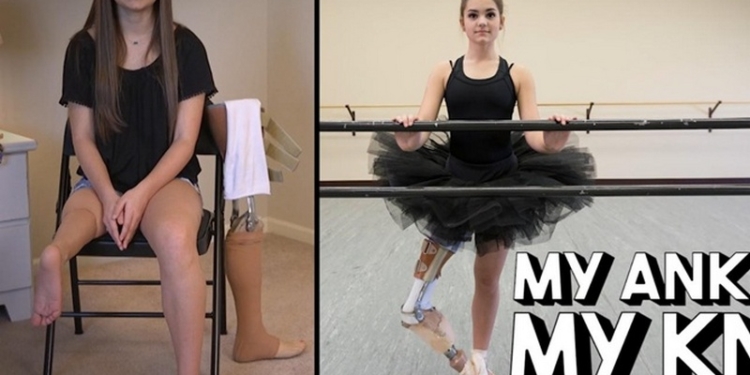 Жажда жизни. 15-летняя балерина танцует, несмотря на ампутированную ногу