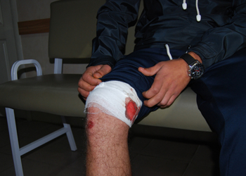 В Николаеве ранены двое полицейских. Подробности конфликта