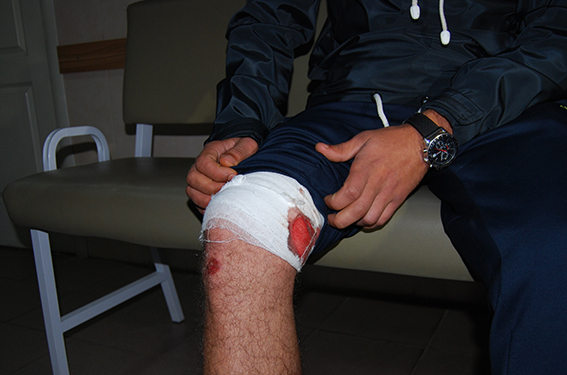 В Николаеве ранены двое полицейских. Подробности конфликта