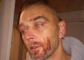 Патрульную полицию Николаева обвиняют в избиении десантника-АТОшника. Полиция оправдывается