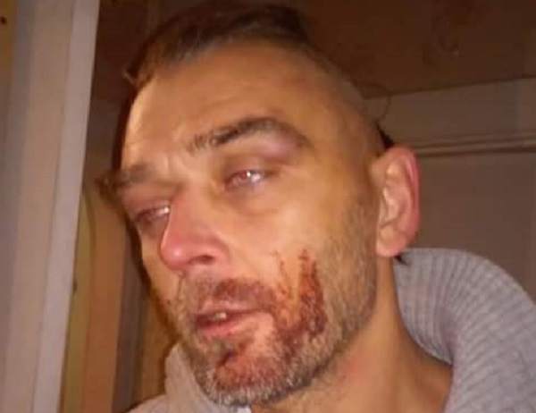 Патрульную полицию Николаева обвиняют в избиении десантника-АТОшника. Полиция оправдывается 2