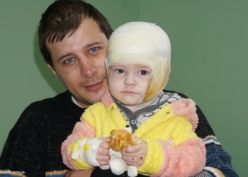 Маленькому Давиду, который обгорел при пожаре в общежитии, сделали операцию