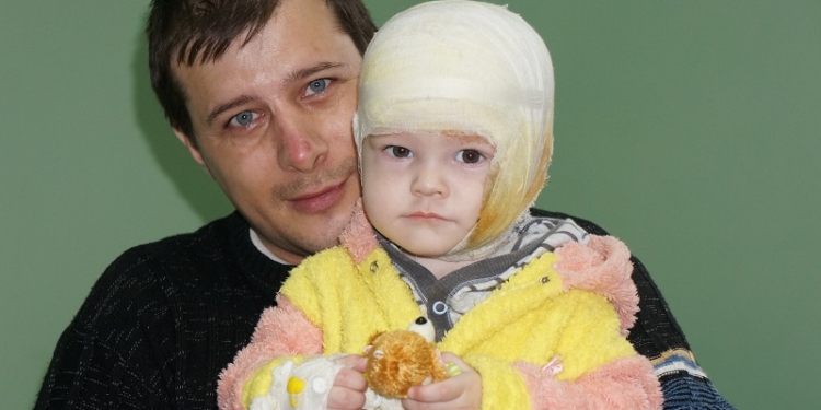 Маленькому Давиду, который обгорел при пожаре в общежитии, сделали операцию