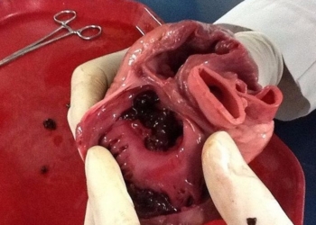 Ученые создали первое в мире сердце на чипе