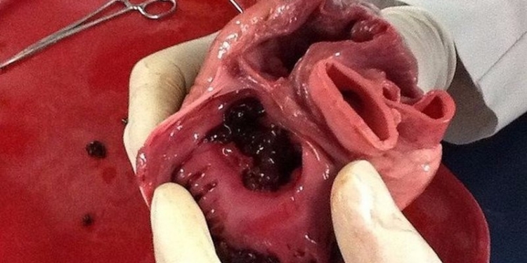 Ученые создали первое в мире сердце на чипе