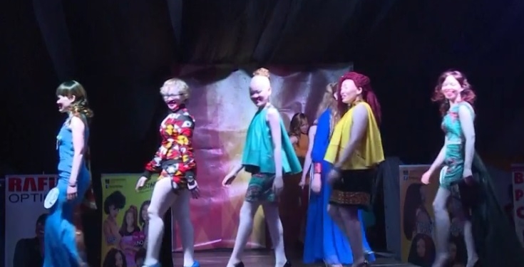 «Красота за пределами кожи». В Африке состоялся первый в мире конкурс негров-альбиносов