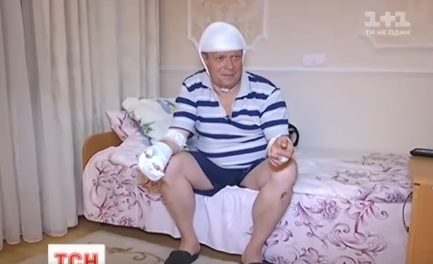 В Киеве зверски избили директора речпорта. Он подозревает “песчаных браконьеров”