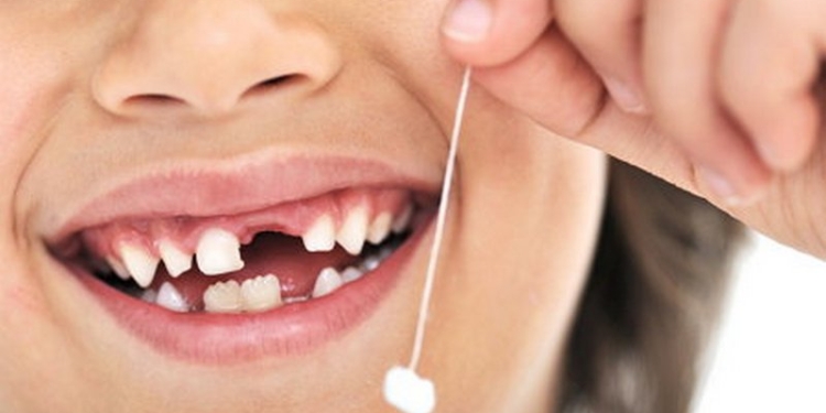 Вы в детстве рвали себе молочные зубы, привязывая ниточку к двери? У этого мальчика в распоряжении было Audi