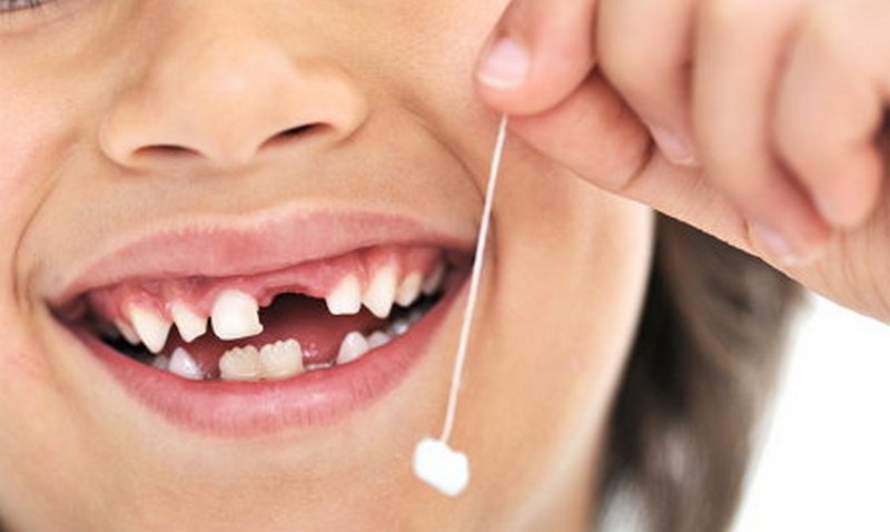 3 самых вредных продуктов для зубов 1