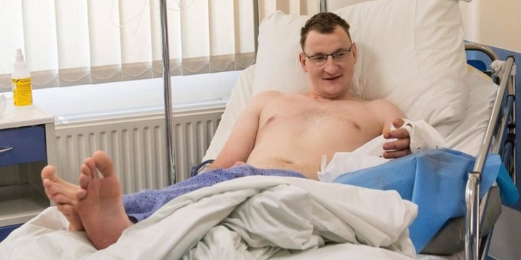 Польские хирурги впервые в мире пересадили руку мужчине, однорукому от рождения