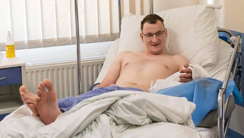 Польские хирурги впервые в мире пересадили руку мужчине, однорукому от рождения 1