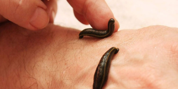 У целителя украли 14 ведер пиявок