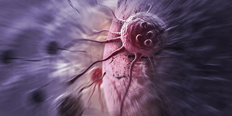 Рак в 2015 году унёс жизни 8,7 миллионов человек по всему миру