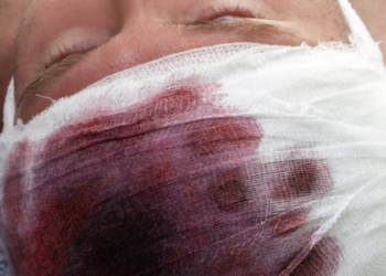 Не мешайте спать соседям: николаевцу разрубили голову за то, что он ночью дразнил собаку