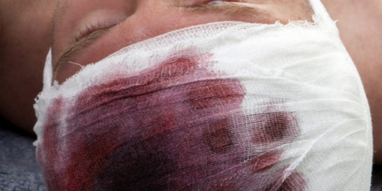 Не мешайте спать соседям: николаевцу разрубили голову за то, что он ночью дразнил собаку