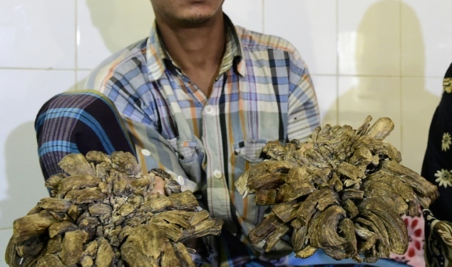 «Человек-дерево» из Бангладеш перенес 16 операций, чтобы избавиться от своих жутких наростов