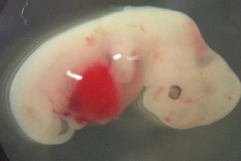 Ученые создали химеру свиньи и человека