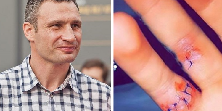 На сына Виталия Кличко напал аллигатор. Парень жив