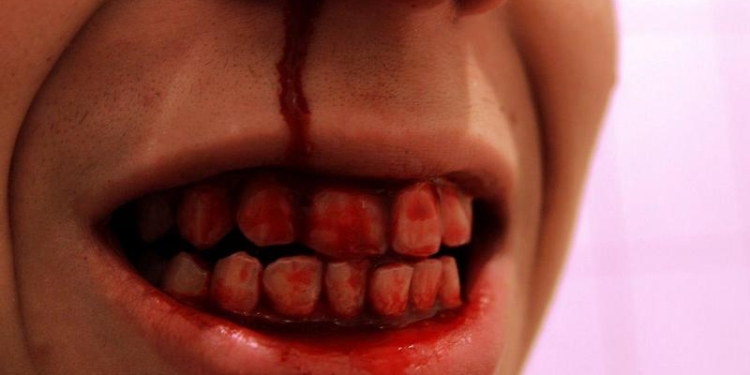 Политические страсти: в споре из-за Трампа мужчина откусил ухо соседу