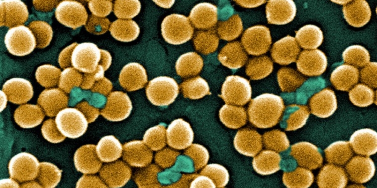 NASA отправит на МКС супербактерию, устойчивую к антибиотикам