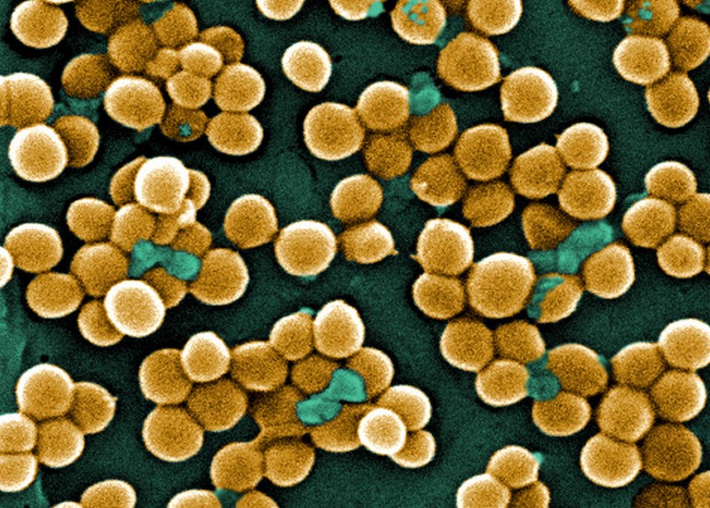 NASA отправит на МКС супербактерию, устойчивую к антибиотикам 1
