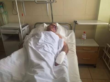 В Одесской области четыре человека избили главу районного совета