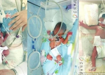 Бывает и так: в Китае на свет появились две девочки спустя неделю после рождения их брата