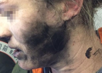 У женщины на борту самолета взорвались наушники