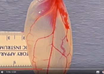 Ученые вырастили сердечную ткань из… шпината