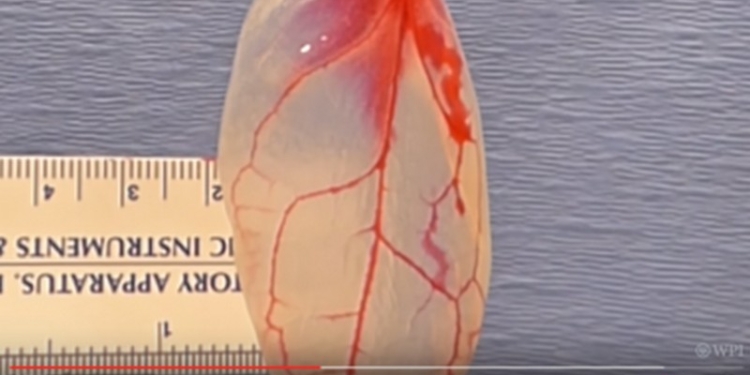 Ученые вырастили сердечную ткань из… шпината