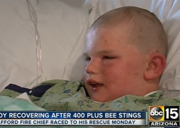 Рой пчел атаковал ребенка в США. Врачи зафиксировали 400 укусов