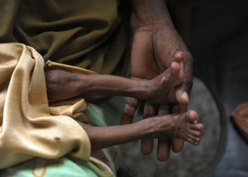 В Сомали за два дня умерли от голода более ста человек