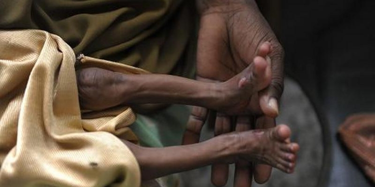 В Сомали за два дня умерли от голода более ста человек