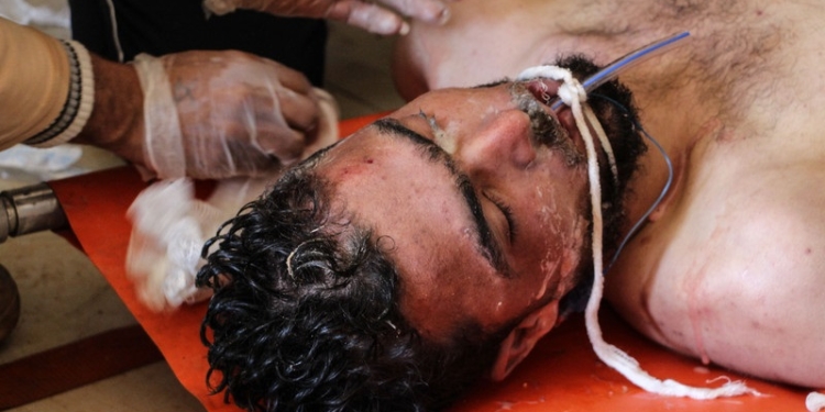 Мир в шоке. После химической бомбардировки в Сирии погибло около 100 человек, еще 400 пытаются спасти (18+)