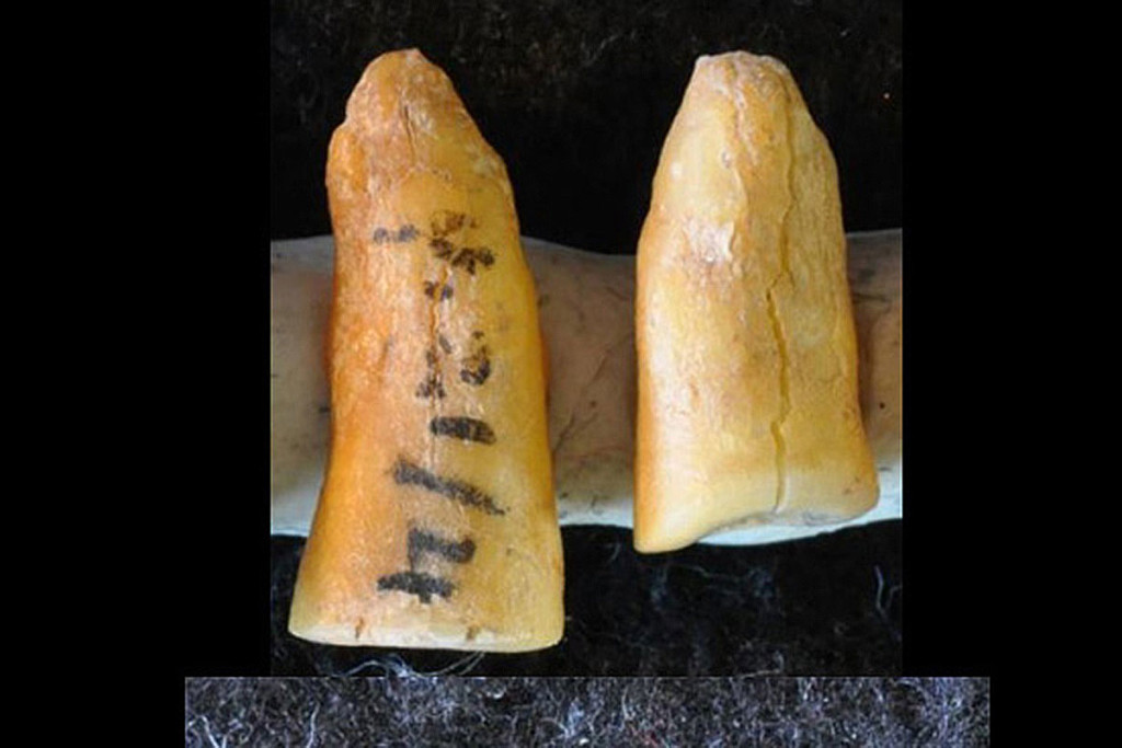 Археологи обнаружили зубные пломбы возрастом 13 тысяч лет 1
