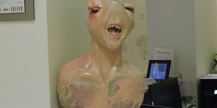 В стоматологической клинике установили памятник из вырванных человеческих зубов