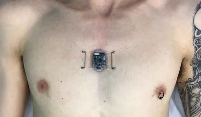 Не гранитный камушек в груди. Житель РФ вживил в себя…компас