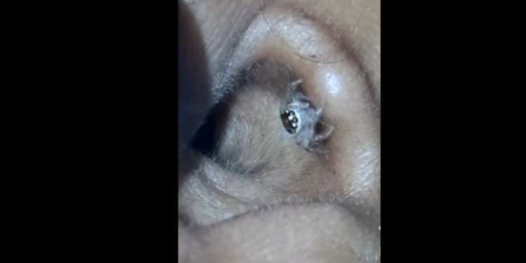 В Индии в ухо женщины залез паук и сплел паутину. Еле изгнали