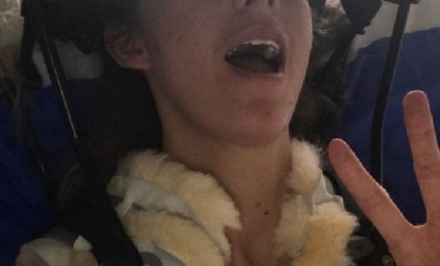 Британка сломала шею, смеясь над шуткой