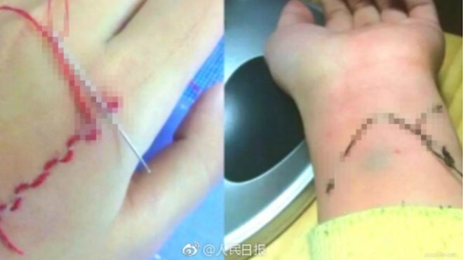 В Китае нет “Синего кита”, поэтому там дети вышивают шелком. По живому телу