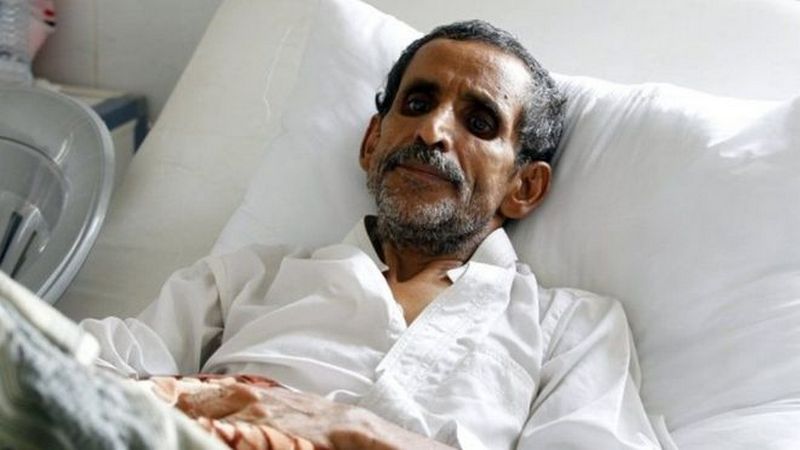 В Йемене от холеры погибло уже 1500 человек 1