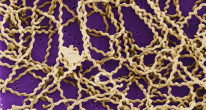 В Херсонской области – 3 случая лептоспироза, один из заболевших умер. Медики Николаевщины просят граждан быть осторожнее