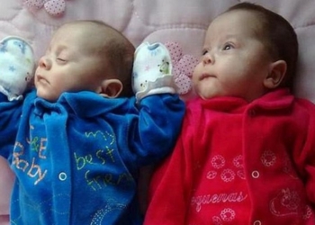 Благодаря бразильским медикам спустя 4 месяца после гибели матери на свет появились ее двойняшки