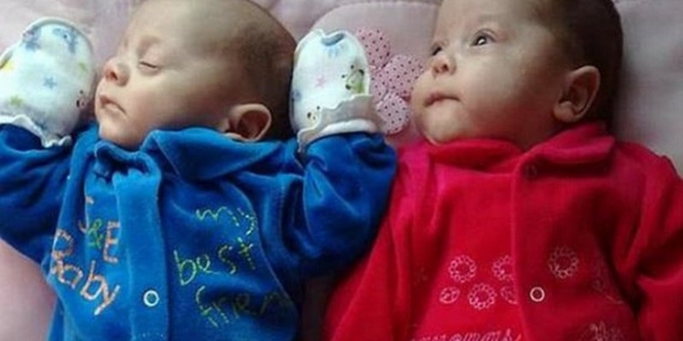 Благодаря бразильским медикам спустя 4 месяца после гибели матери на свет появились ее двойняшки