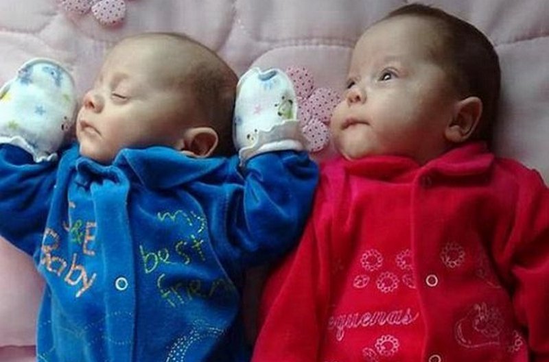 Благодаря бразильским медикам спустя 4 месяца после гибели матери на свет появились ее двойняшки 1