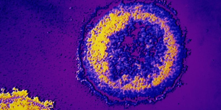 В США врачи утверждают, что полностью вылечили больного ВИЧ ребенка