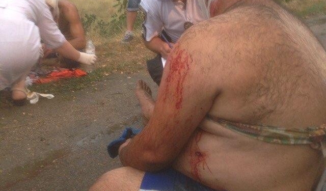 Под Николаевом на трассе неизвестные напали на автомобиль: водитель получил несколько ударов ножом, пассажир ранен из «травмата»