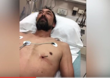 “Мне нужна новая рубашка”. Мужчина с гвоздем в сердце сам приехал в больницу