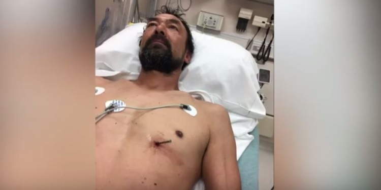 “Мне нужна новая рубашка”. Мужчина с гвоздем в сердце сам приехал в больницу
