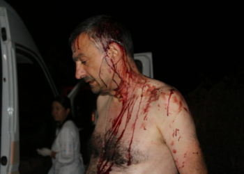 В Одесской области железными битами избили редактора газеты